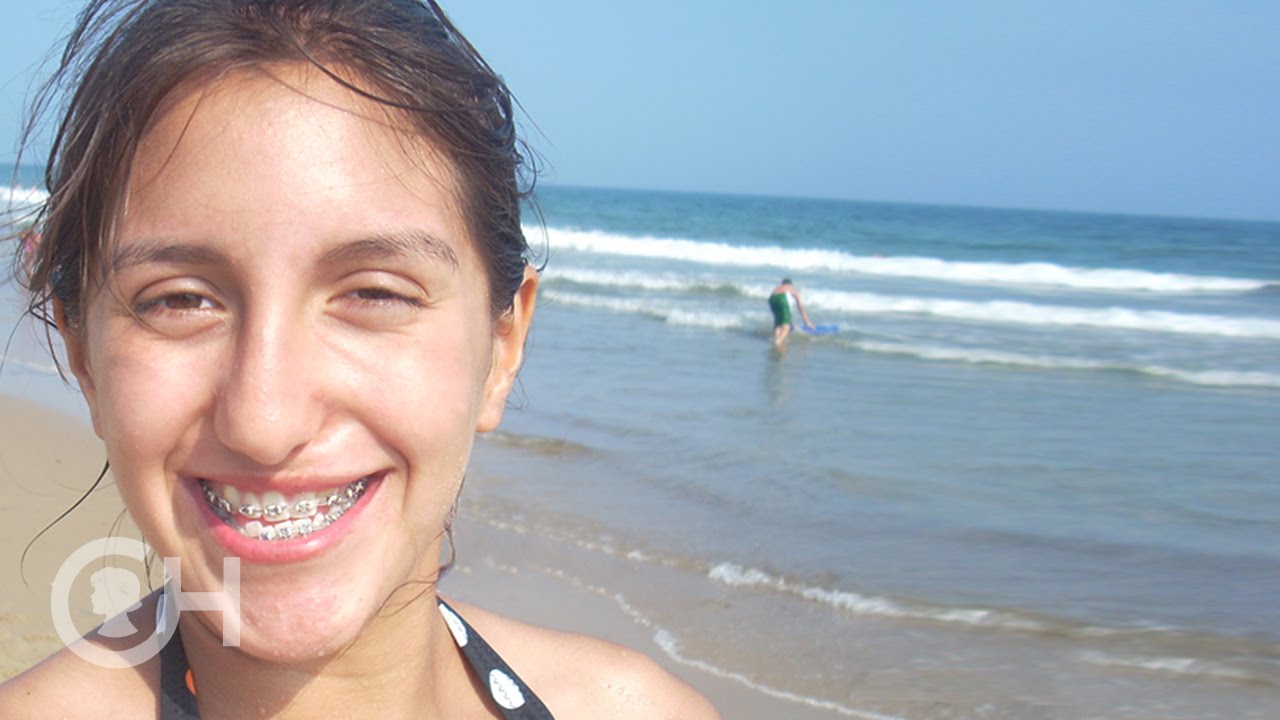 Cleft Lip and Palate: Meet the Baez Family (6 of 7)
