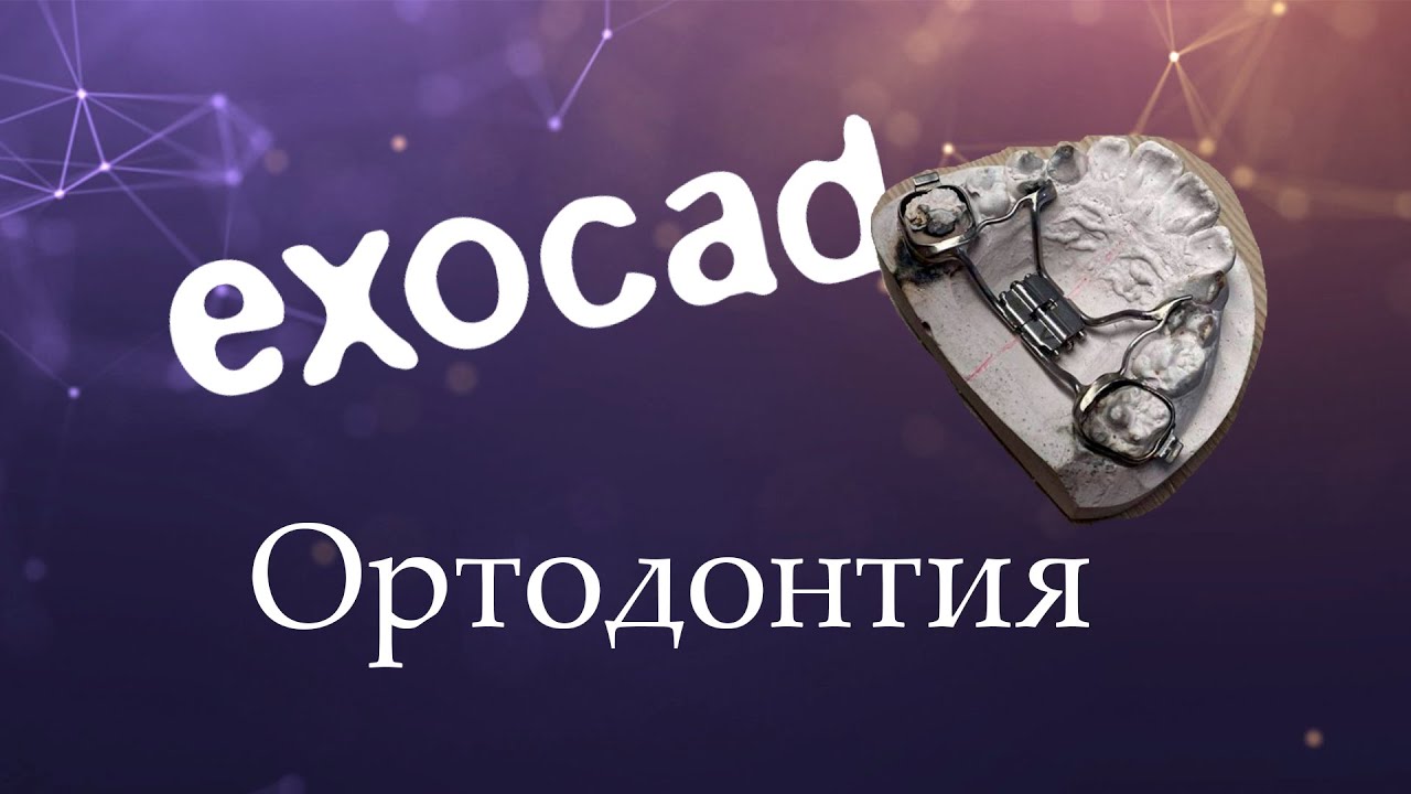 EXOCAD Ортодонтический аппарат с расширяющим винтом в PartialCAD