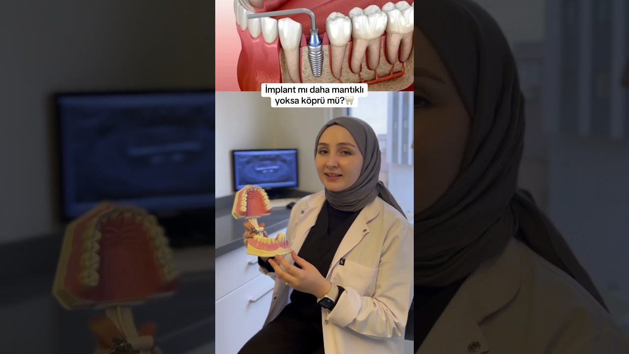 İmplant mı daha mantıklı yoksa köprü mü?