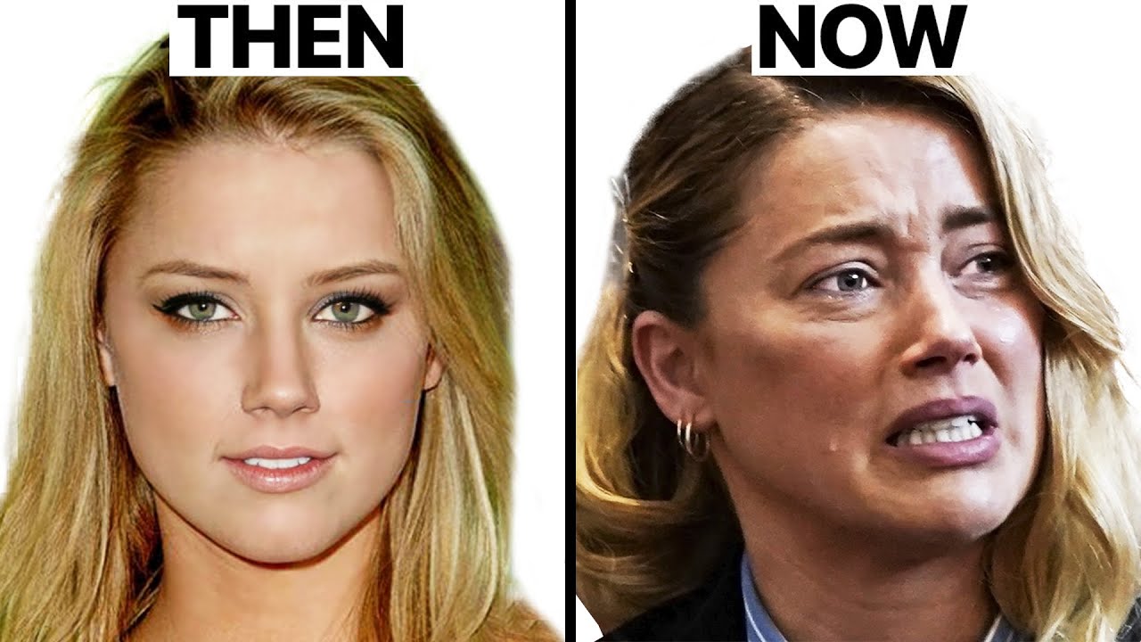 Amber Heard’s New Look - Plastic Surgery Analysis