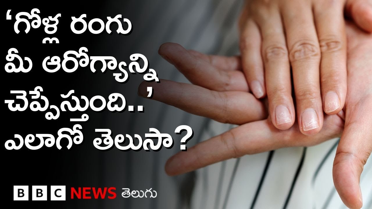 Nail: మీ గోళ్ల రంగును ఎప్పుడైనా చూసుకున్నారా? వాటి రంగును బట్టి ఆరోగ్య లక్షణాలను చెప్పవచ్చా?