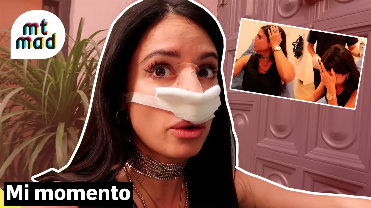 Inma ense&ntilde;a el resultado de su rinoplastia en exclusiva: &ldquo;Ten&iacute;a ganas de ver mi nueva nariz&rdquo; | MTMAD