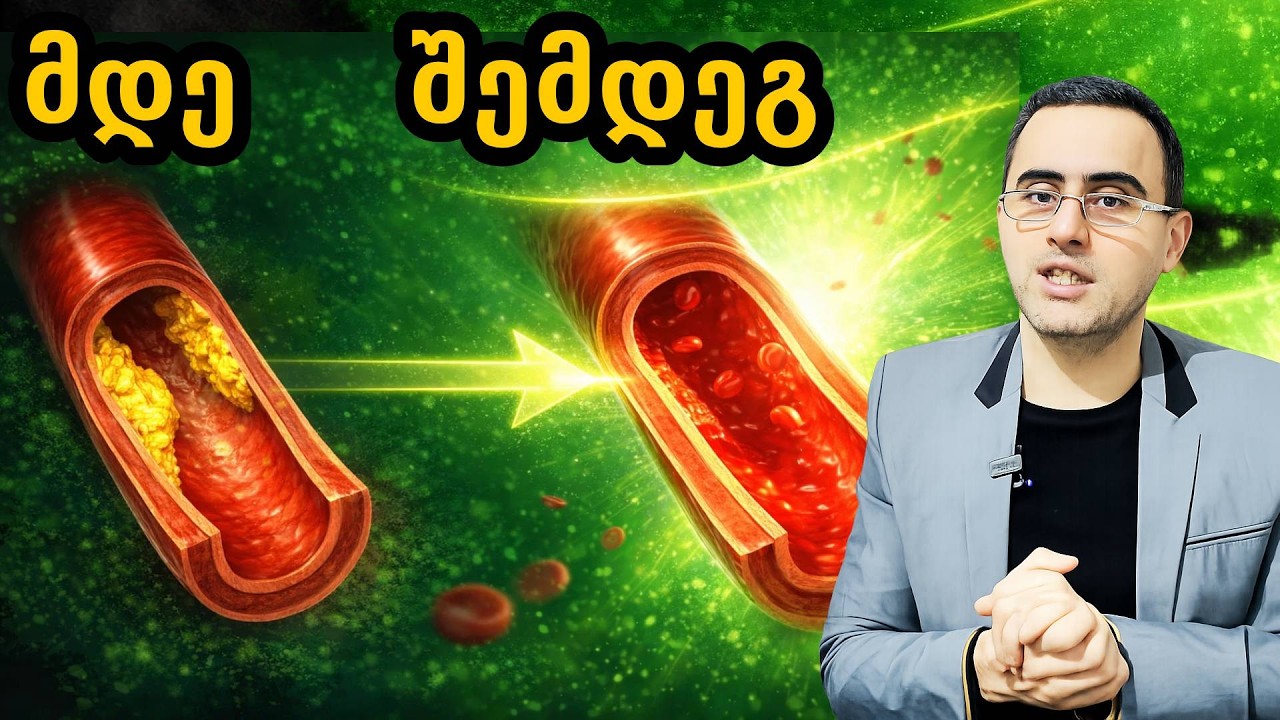 5 საკვები რომელიც სისხლძარღვებს გაგიწმენდს ქოლესტერინისგან