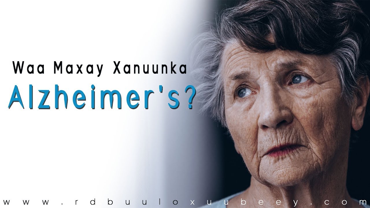 Waa Maxay Xanuunka Loo Yaqaan Alzheimer's Maxaase Sababa?