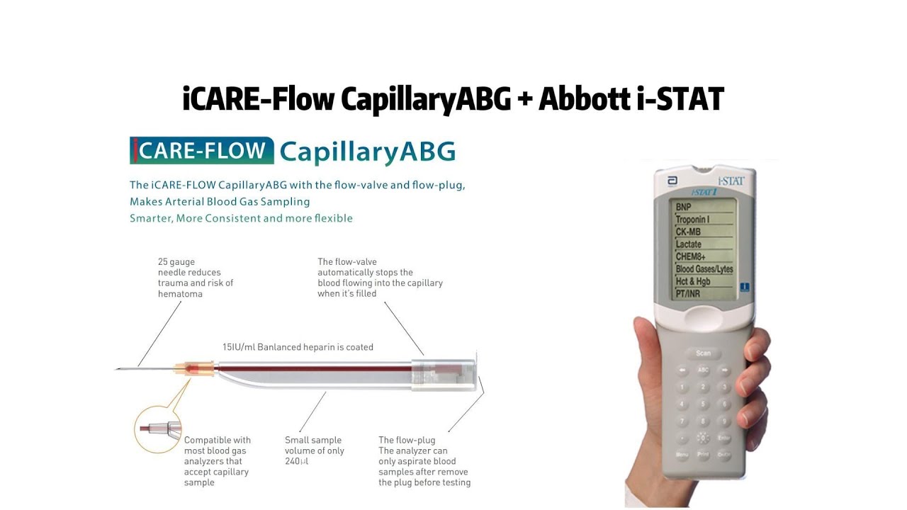 Radial ABG Sampling and testing with Abbott i-STAT POCT Analyzer