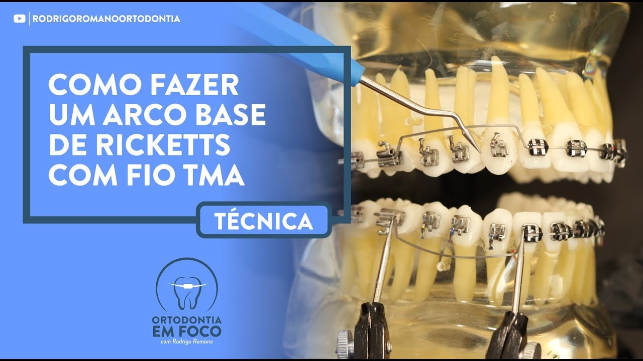Como fazer um Arco Base de Ricketts com fio TMA - Técnica Ortodôntica