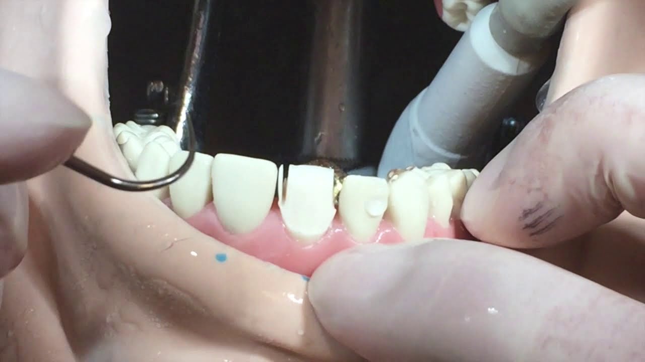 Video PFU C. Basica