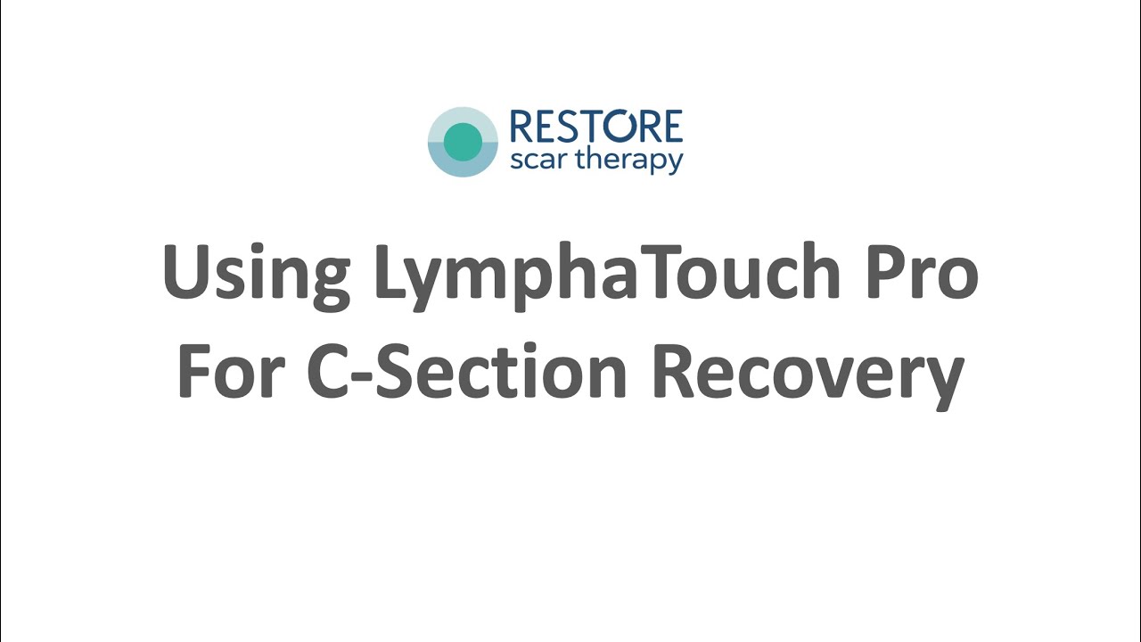 LymphaTouch Pro C-Section Scar Massage Demonstration