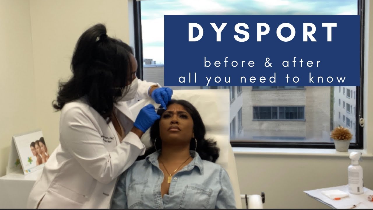 DYSPORT INJECTIONS! Forehead and 11&rsquo;s, Dysport vs Botox, Pain, Before & After, Worth It?!