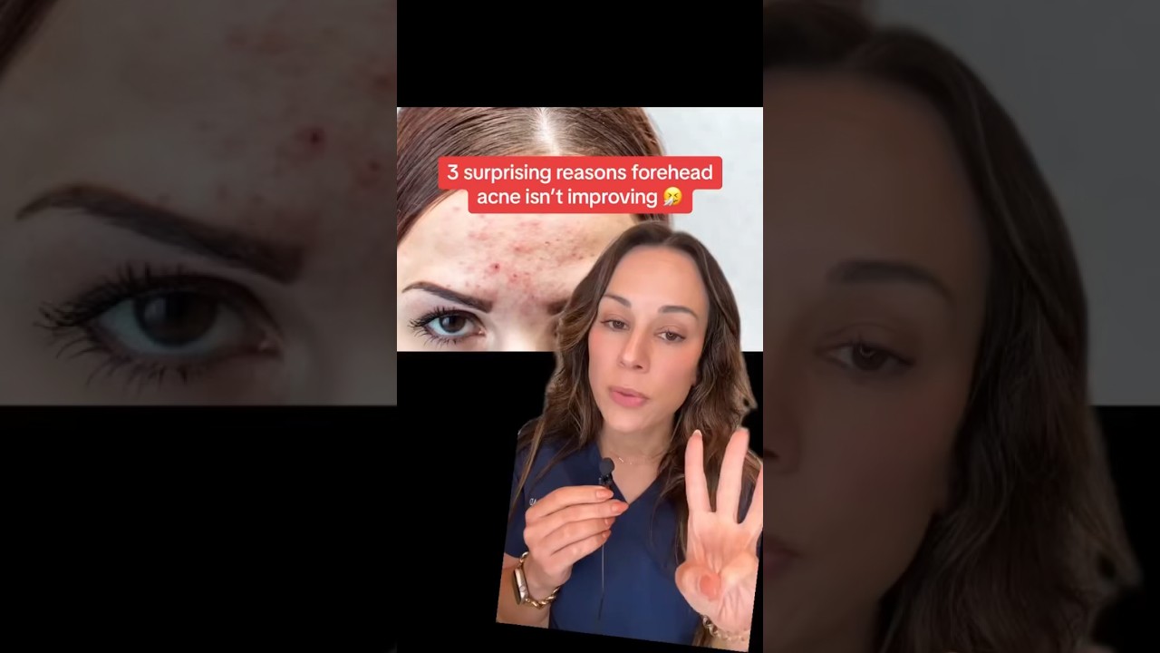 Dermatologist Reveals 3 Surprising Reasons Forehead Acne Isn&rsquo;t Improving #shorts #skincare |