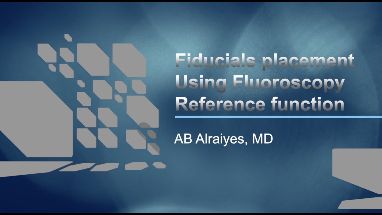 Fiducial Markers Placement Using REBUS and ION robotic bronchoscopy Fluoroscopy Reference Function