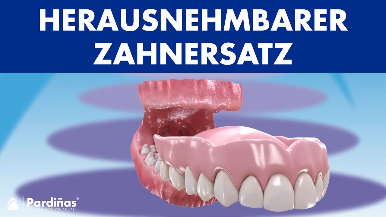Herausnehmbarer ZAHNERSATZ - Reinigung und Pflege von VOLLPROTHESEN ©