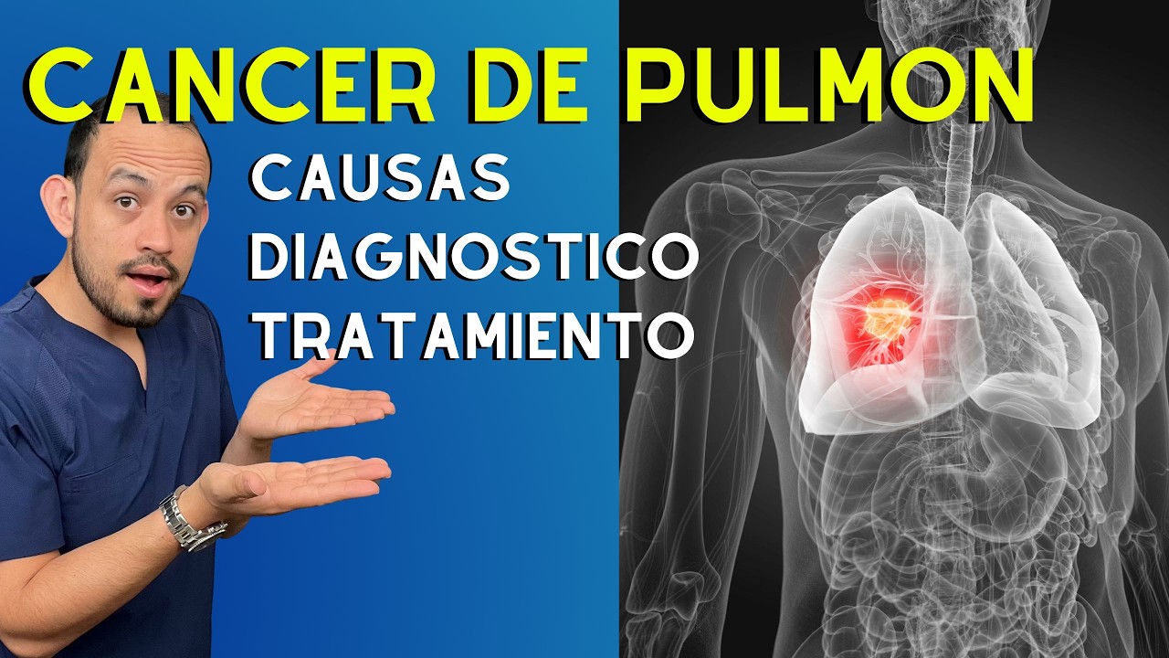 Cáncer de Pulmón: Causas, Diagnóstico y Tratamiento | Dr. Francisco Armas