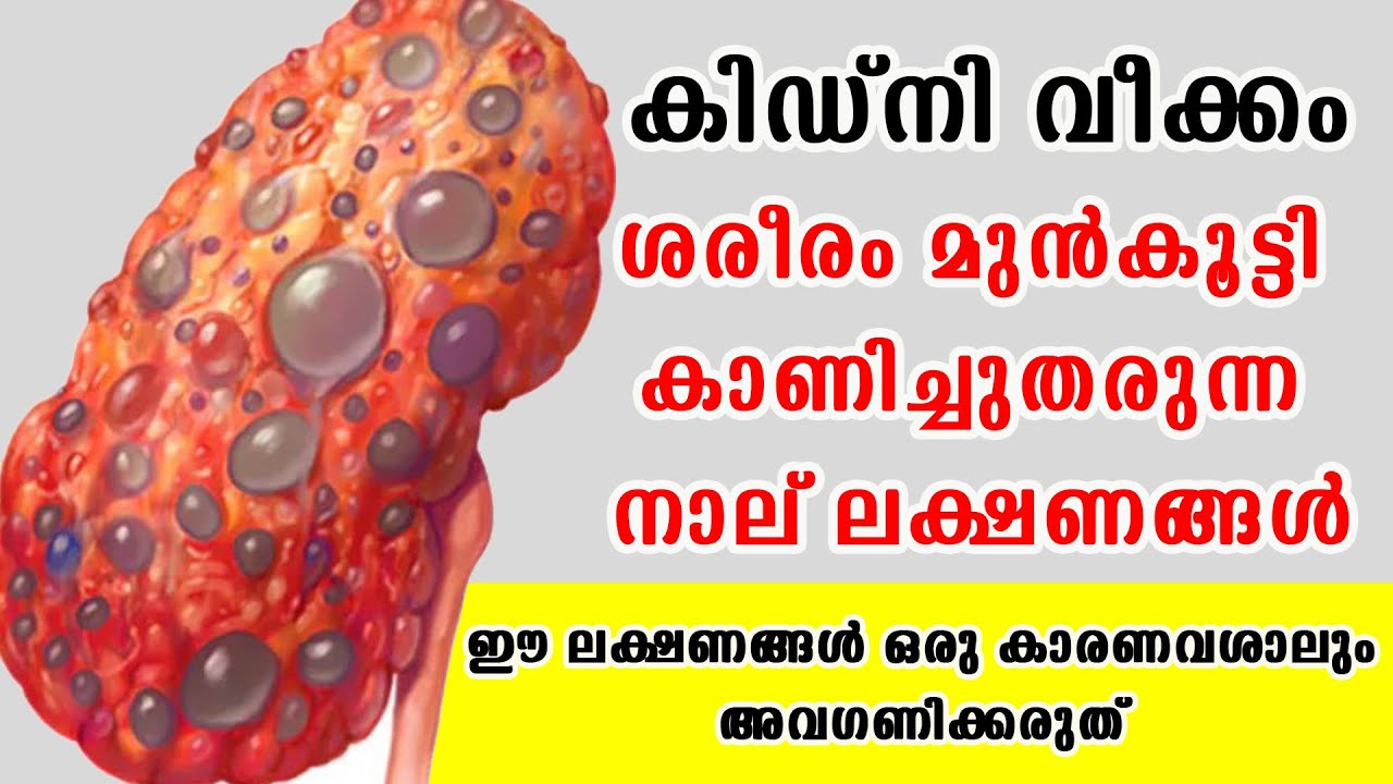 കിഡ്‌നി വീക്കം ശരീരം മുൻകൂട്ടി കാണിച്ചുതരുന്ന നാല് ലക്ഷണങ്ങൾ /Baiju's Vlogs