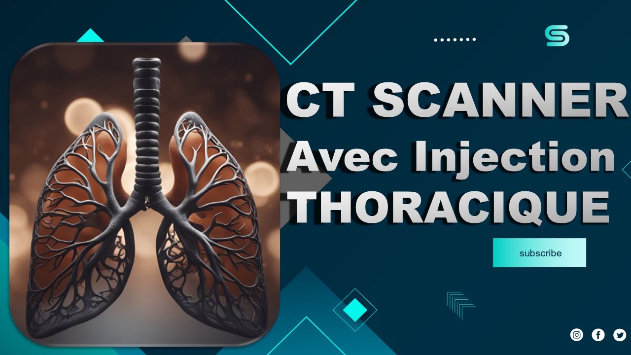 CT Scanner THORACIQUE (Avec Injection) - Partage de Pratiques