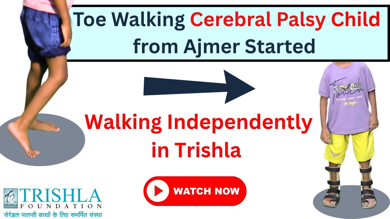 Hemiplegic Spastic Cerebral Palsy Patient (Child) Started Walking | Trishla Foundation