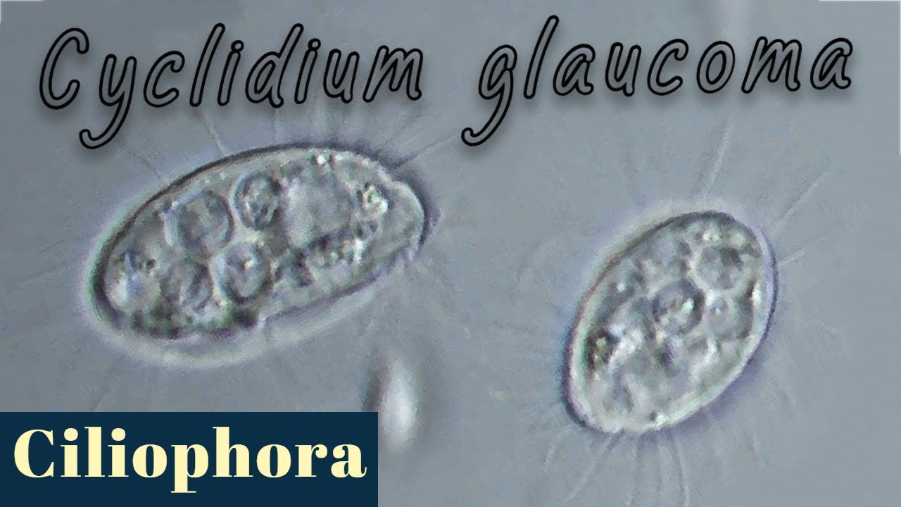 Cyclidium glaucoma, common species of ciliates.