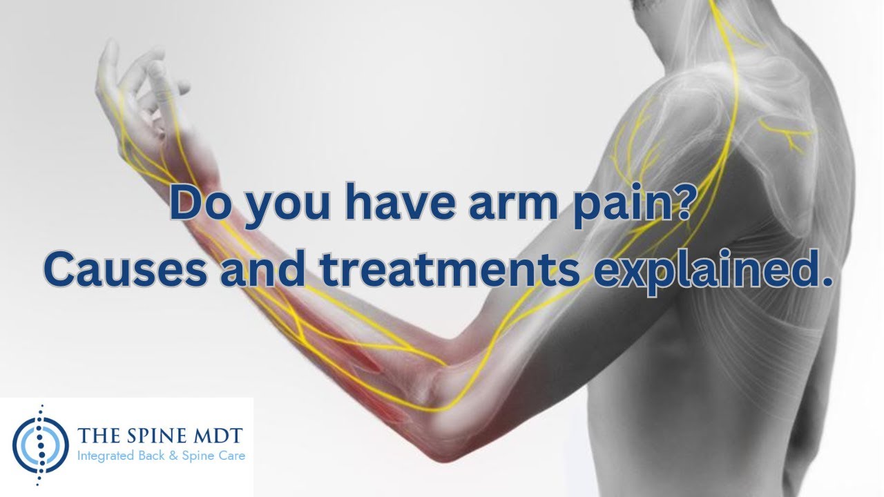 Do you have arm pain? Causes and treatments explained.