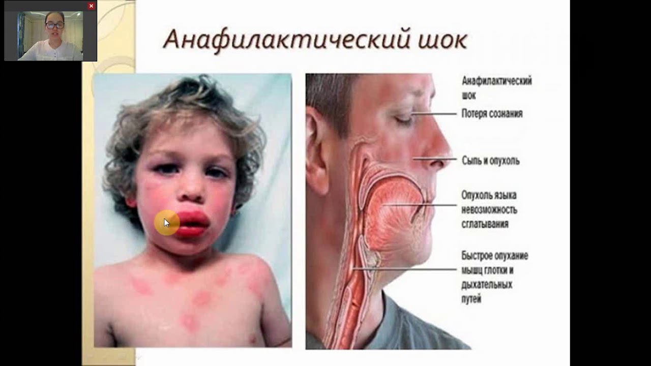 6 сабақ патология