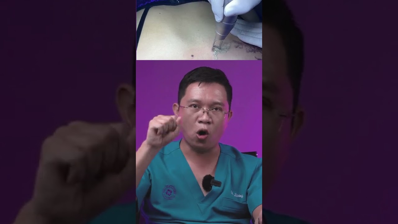 BÍ MẬT ĐẰNG SAU XOÁ XĂM BẰNG LASER| BÁC SĨ LƯƠNG