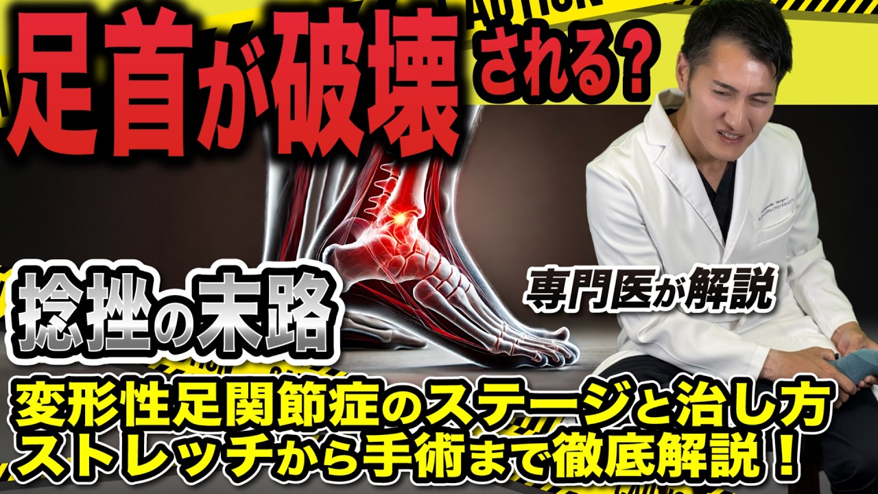 【放置厳禁！足首 の痛み 】変形性足関節症 の初期症状 と治し方 ｜手術 の選択肢まで徹底解説！
