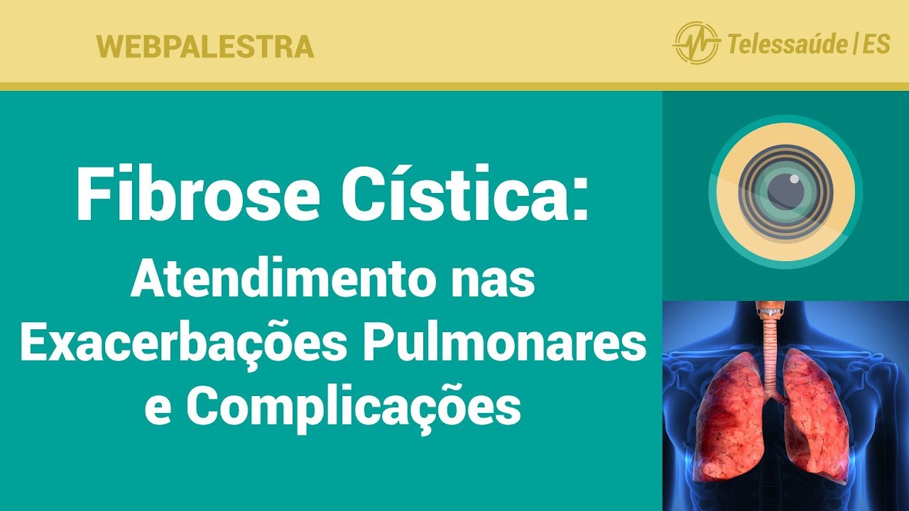 WebPalestra: Fibrose C&iacute;stica - Atendimento nas Exacerba&ccedil;&otilde;es Pulmonares e Complica&ccedil;&otilde;es