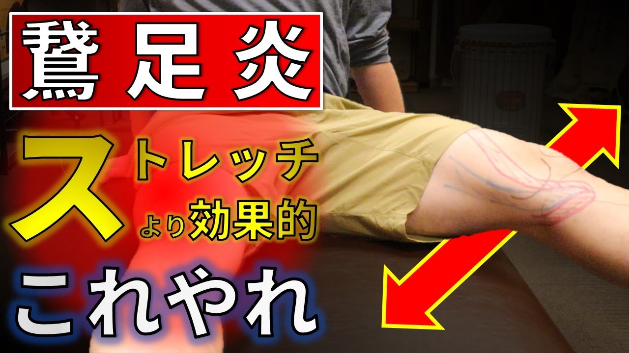 鵞足炎の痛みを改善！ストレッチよりもこれをやれ！ゆるゆる体操3選【膝内側痛】