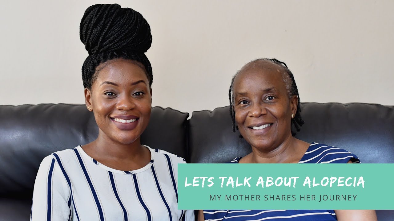 My Mother’s Hair Loss Journey; Experience and Advice|| Lets talk about Alopecia