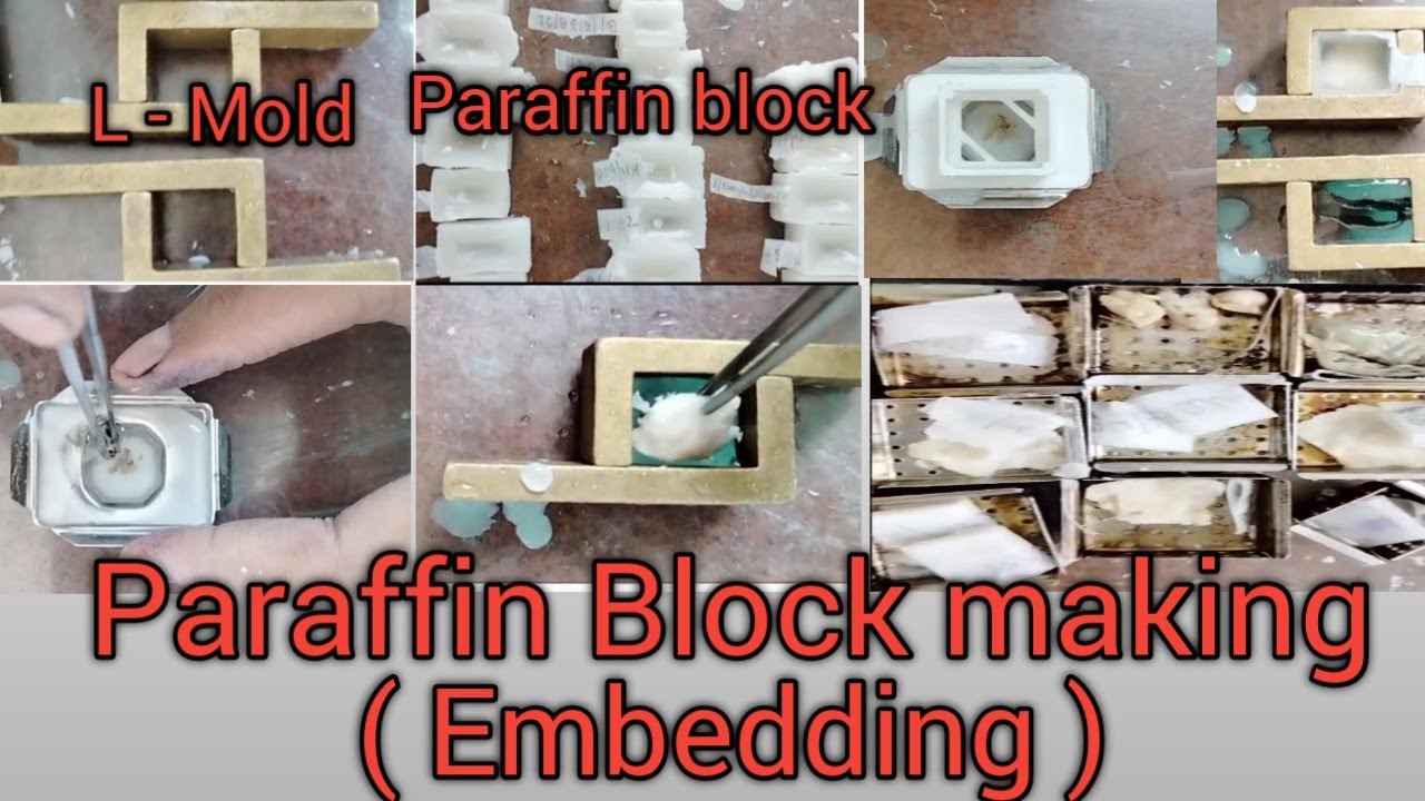 Embedding || Paraffin Tissue Block || Histopathology में Blocking करना सीखें ||  L -Mold