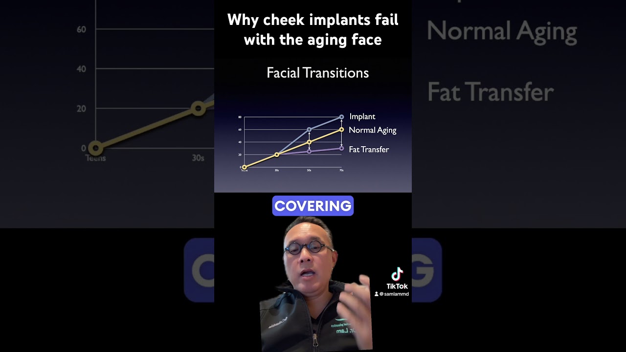Why cheek implants fail with the aging face