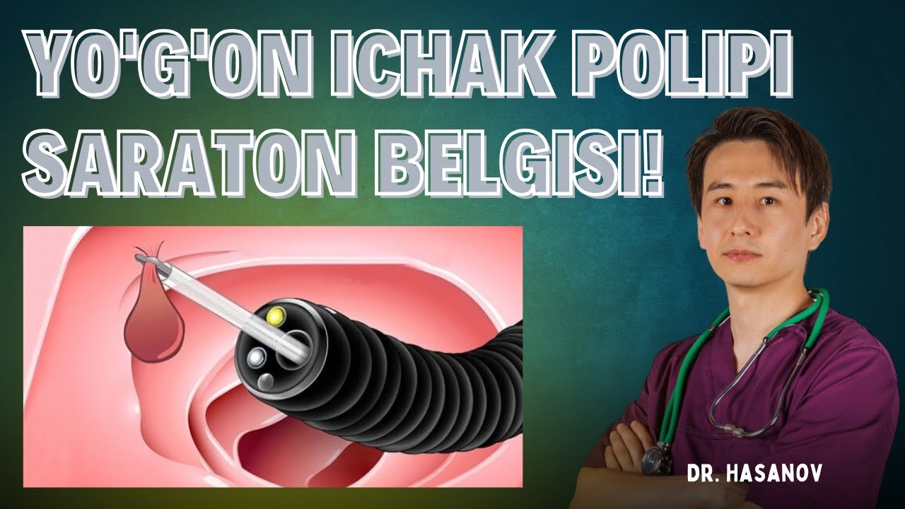 Yo'g'on ichak polipi SARATON belgisi!