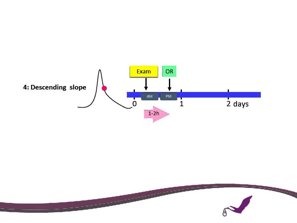 Oocyte retrieval timing based on spontaneous LH surge during natural cycle IVF