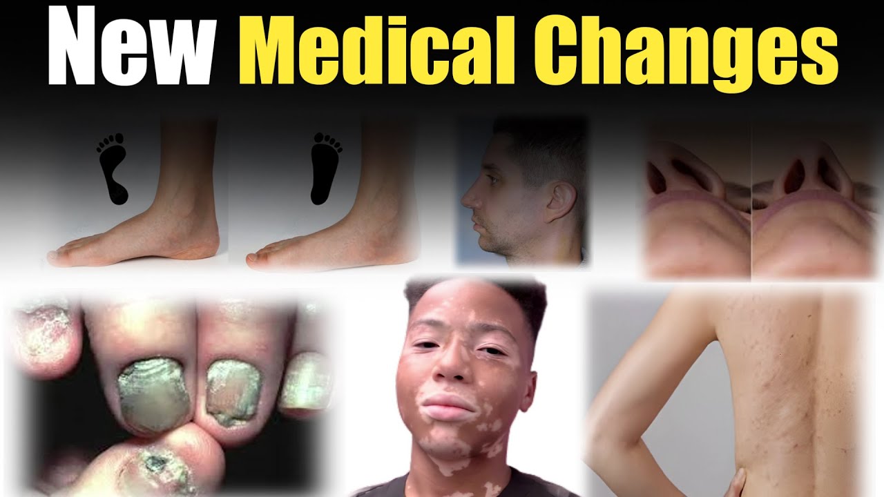 Pakistan Army Medical Test | PMA Long Course Initial Medical Test