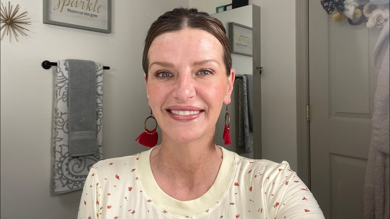 What it’s like having dentures | 14 months with dentures | Dentures
