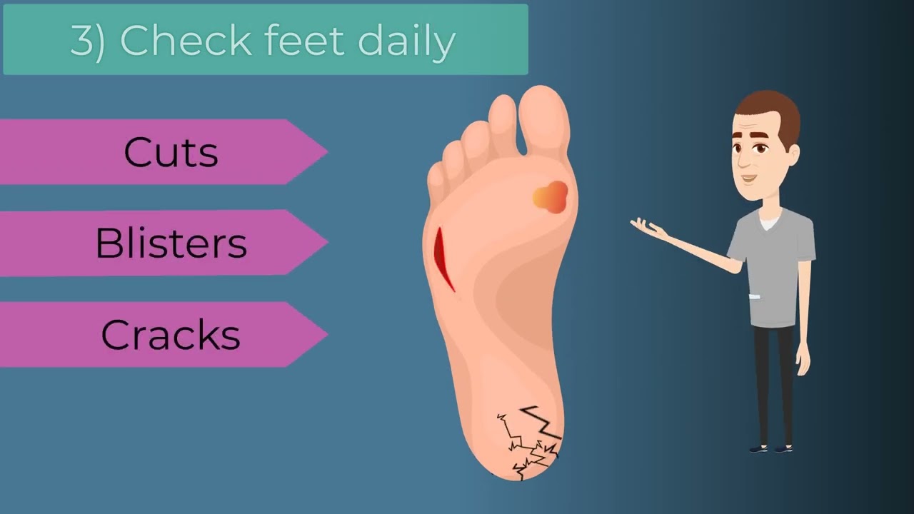 Footcare for people with Diabetes