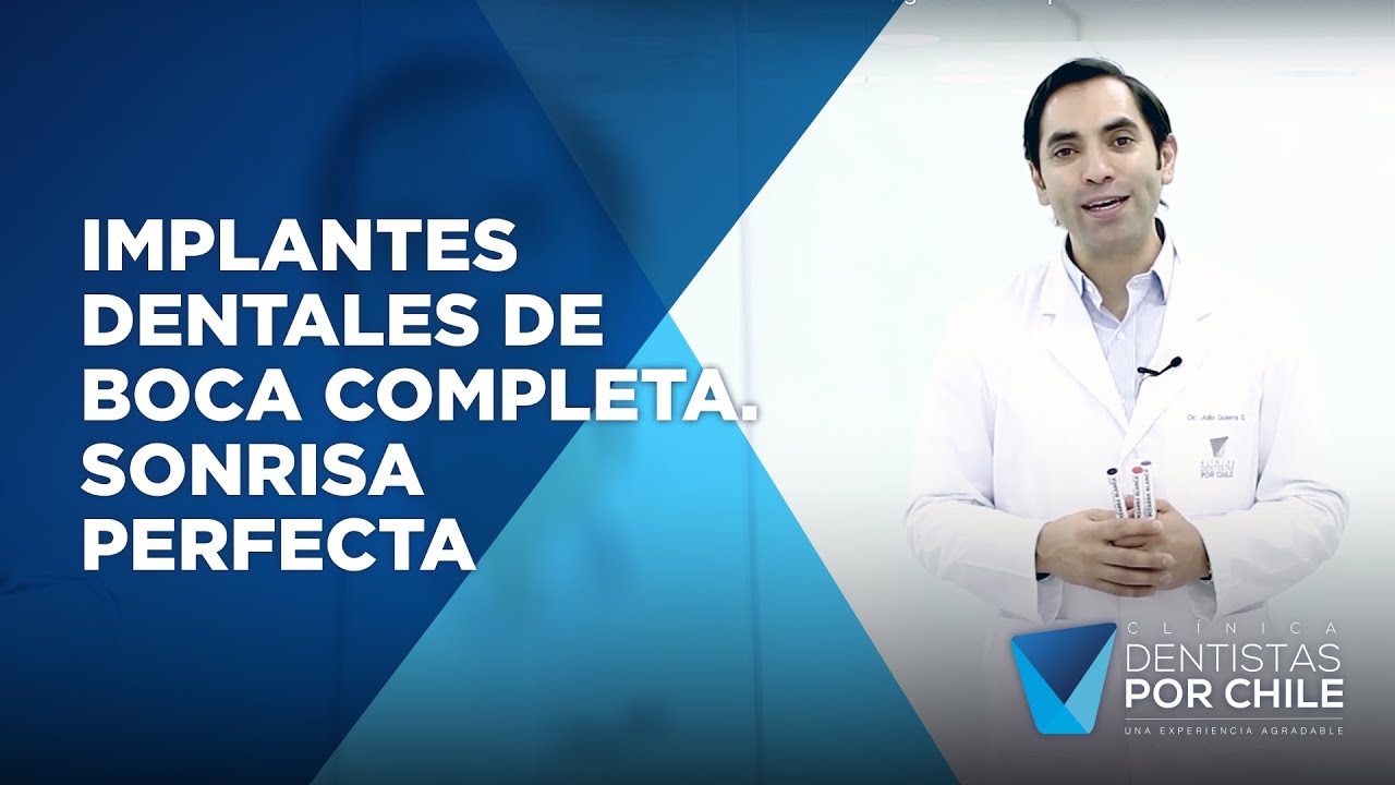 No escondas más tu sonrisa, gracias a los implantes dentales boca completa