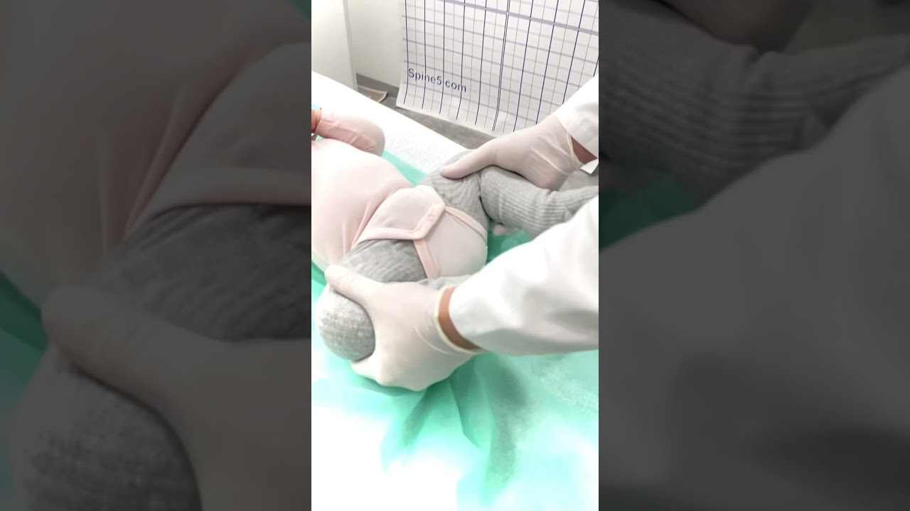 Проверить суставы у Детского ортопеда. Дисплазия тбс