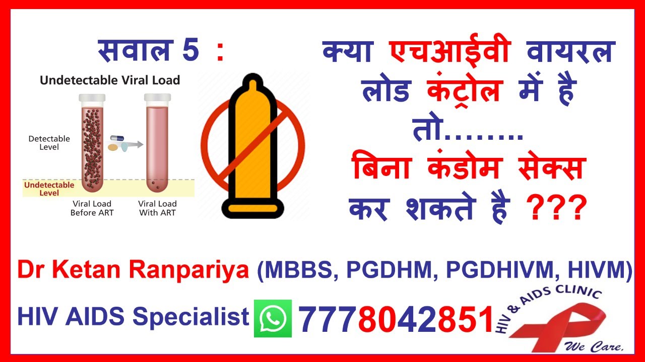hiv viral load tnd | undetectable hiv untransmittable | hiv u=u | hiv undetectable | hiv viral load