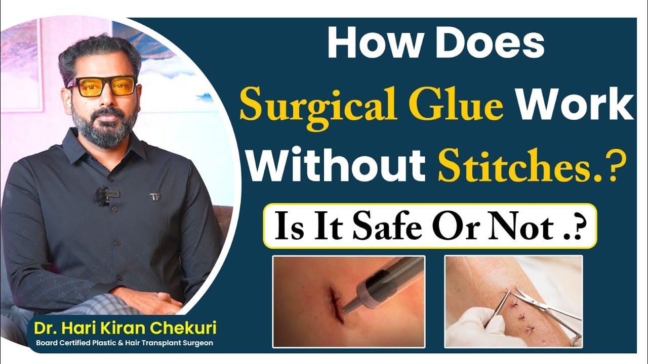 How Surgical Glue Works Without Stitches | Advanced Wound Closure Explained | Redefine