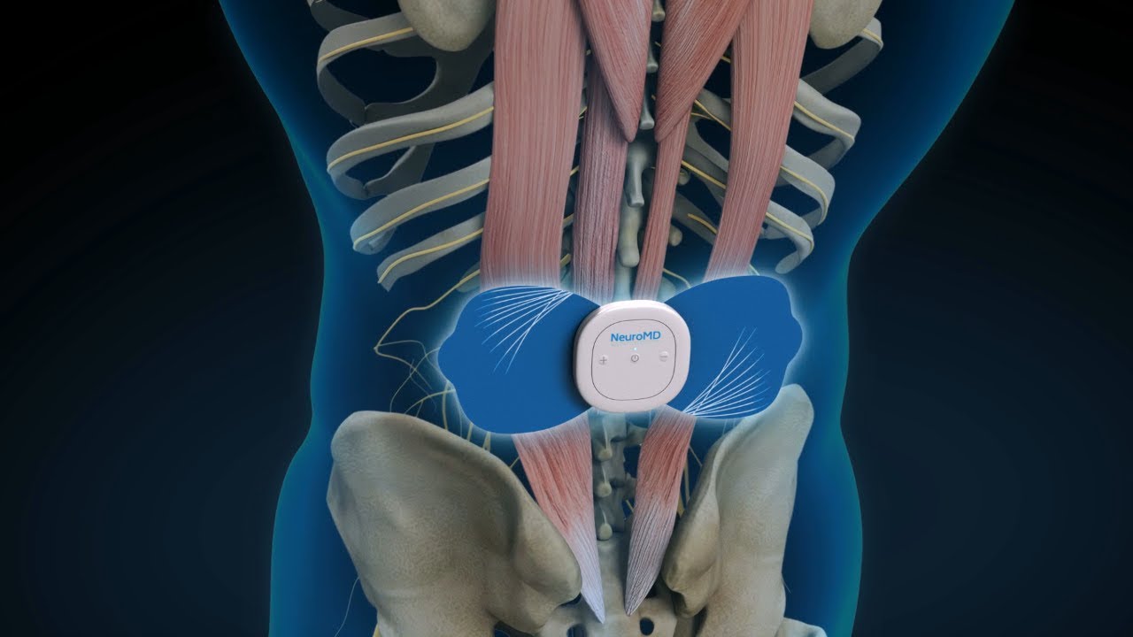 How Does NeuroMD&trade; Work?