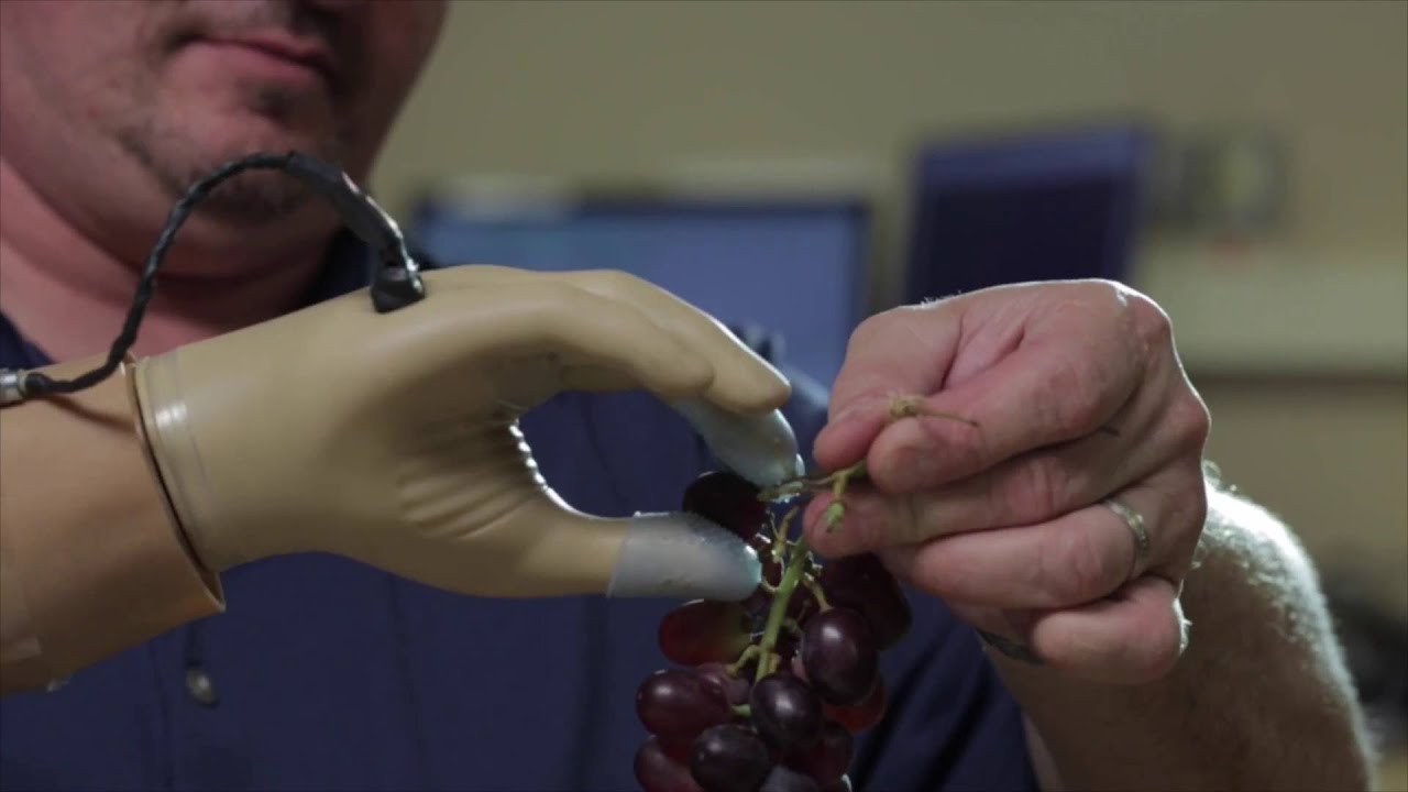 Prosthetic Hand Restores Amputee's Sense of Touch