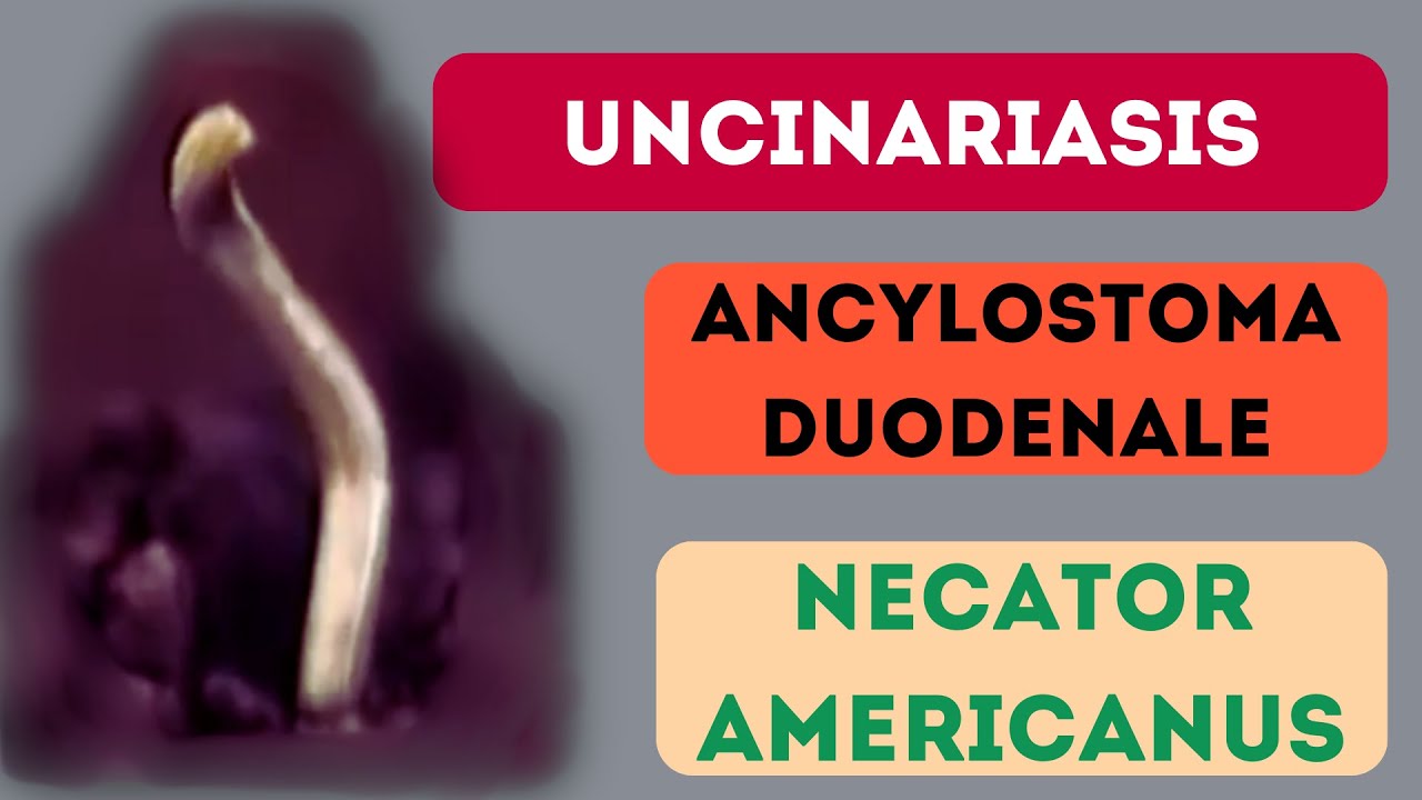 UNCINARIASIS | ANCYLOSTOMA DUODENALE Y NECATOR AMERICANUS