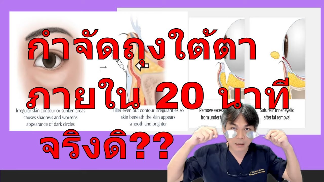 ถุงใต้ตา กำจัดอย่างไรภายใน 20 นาที จริงดิ???   !!!!