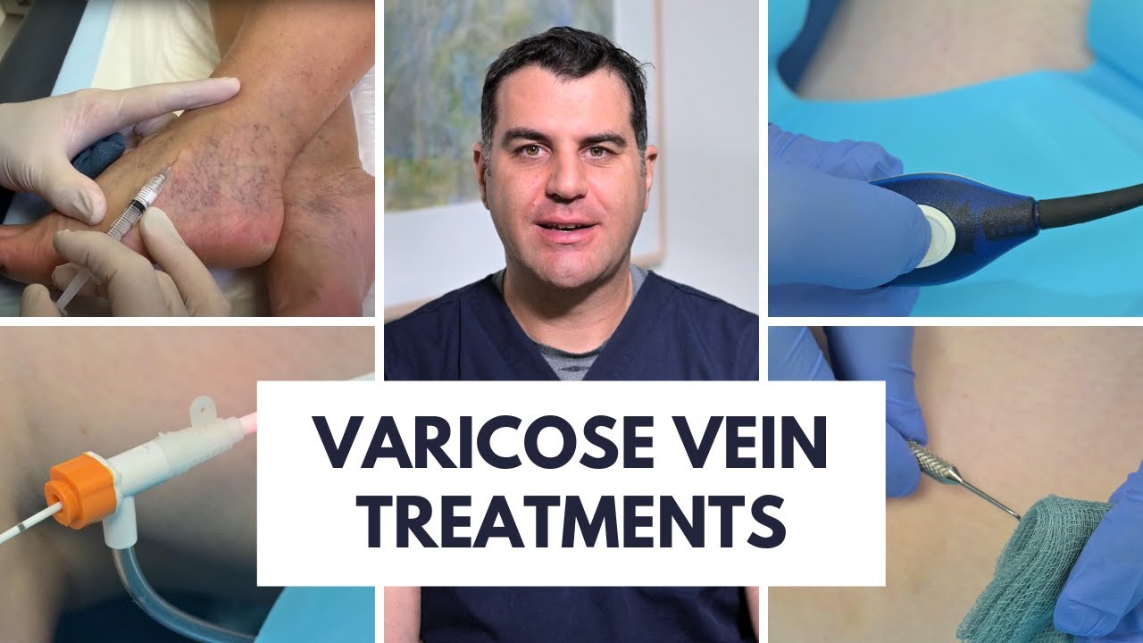 Varicose Vein Treatment Options - Dr Peter Paraskevas from Vein Health Medical Clinic