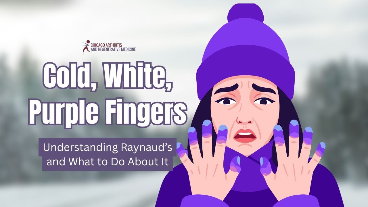 Cold, White, Purple Fingers Understanding Raynaud’s and What to Do About It