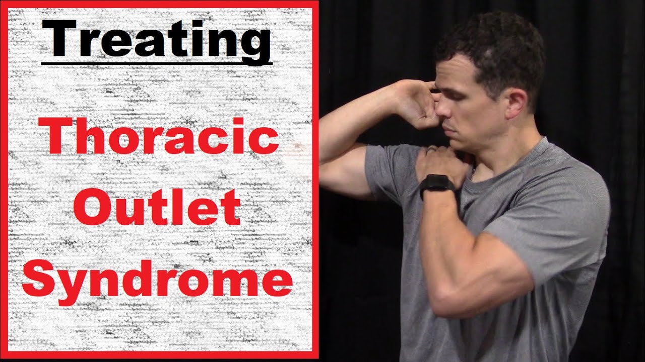 Treating Thoracic Outlet Syndrome