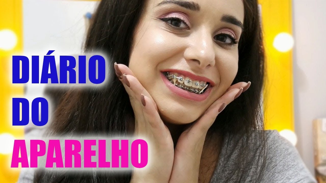 DIÁRIO DO APARELHO | 1 ANO DEPOIS...