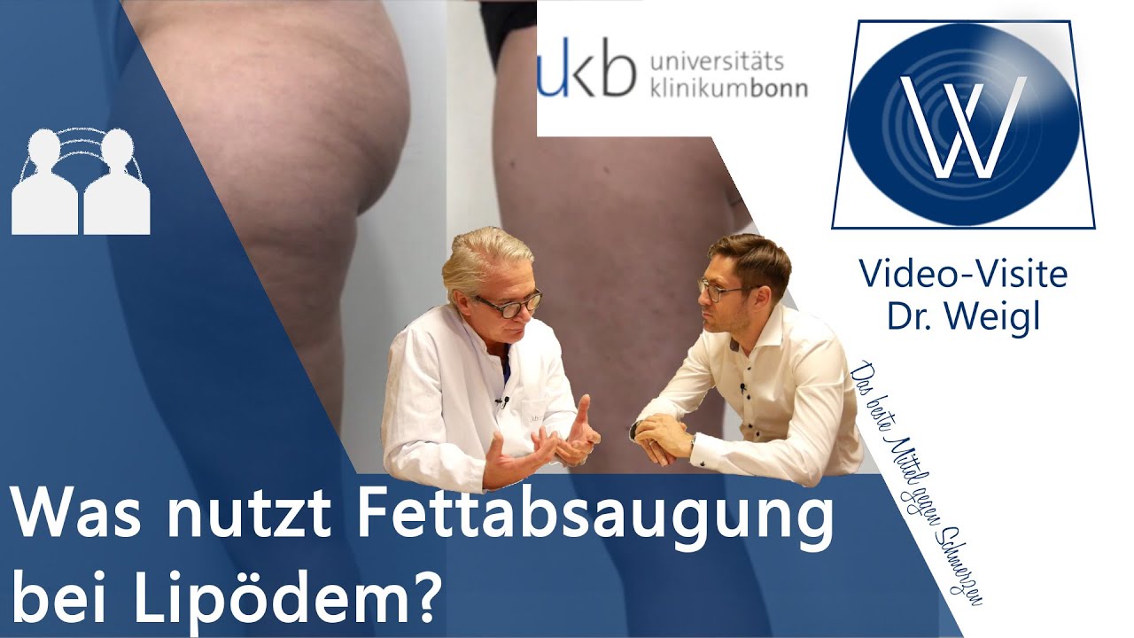 Lipödem & dicke Beine durch Fettabsaugung für immer weg: Tipps & OP-Erfahrungen mit Dr. Walgenbach