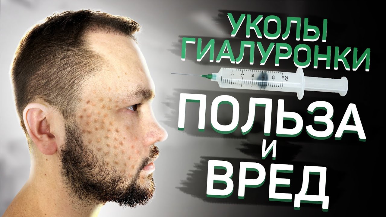 Биоревитализация. Что ждать от процедуры ?