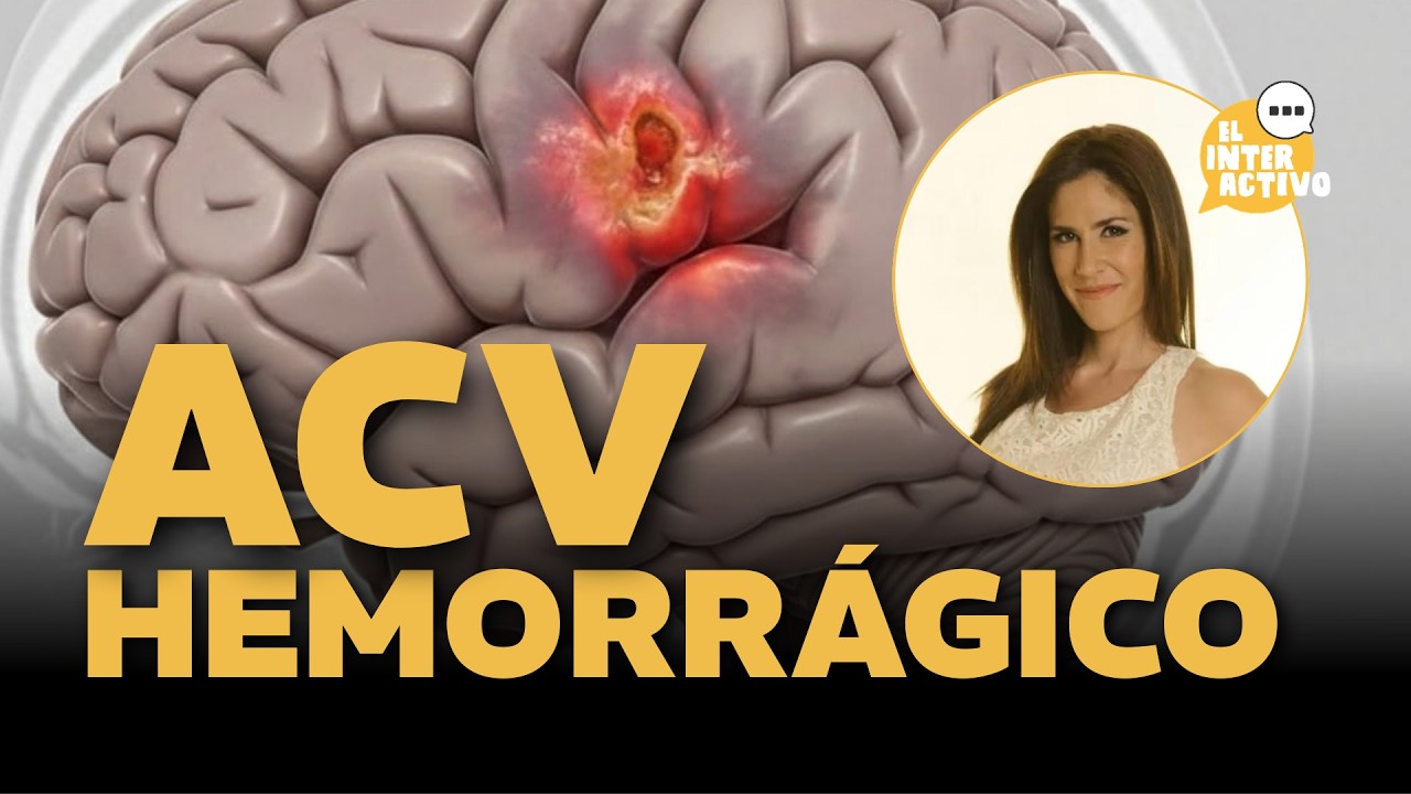 Daniela Ballerter: Qué es un ACV hemorrágico y cómo detectarlo a tiempo